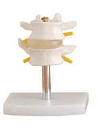 Bodyline Lumbar Vertebrae Model