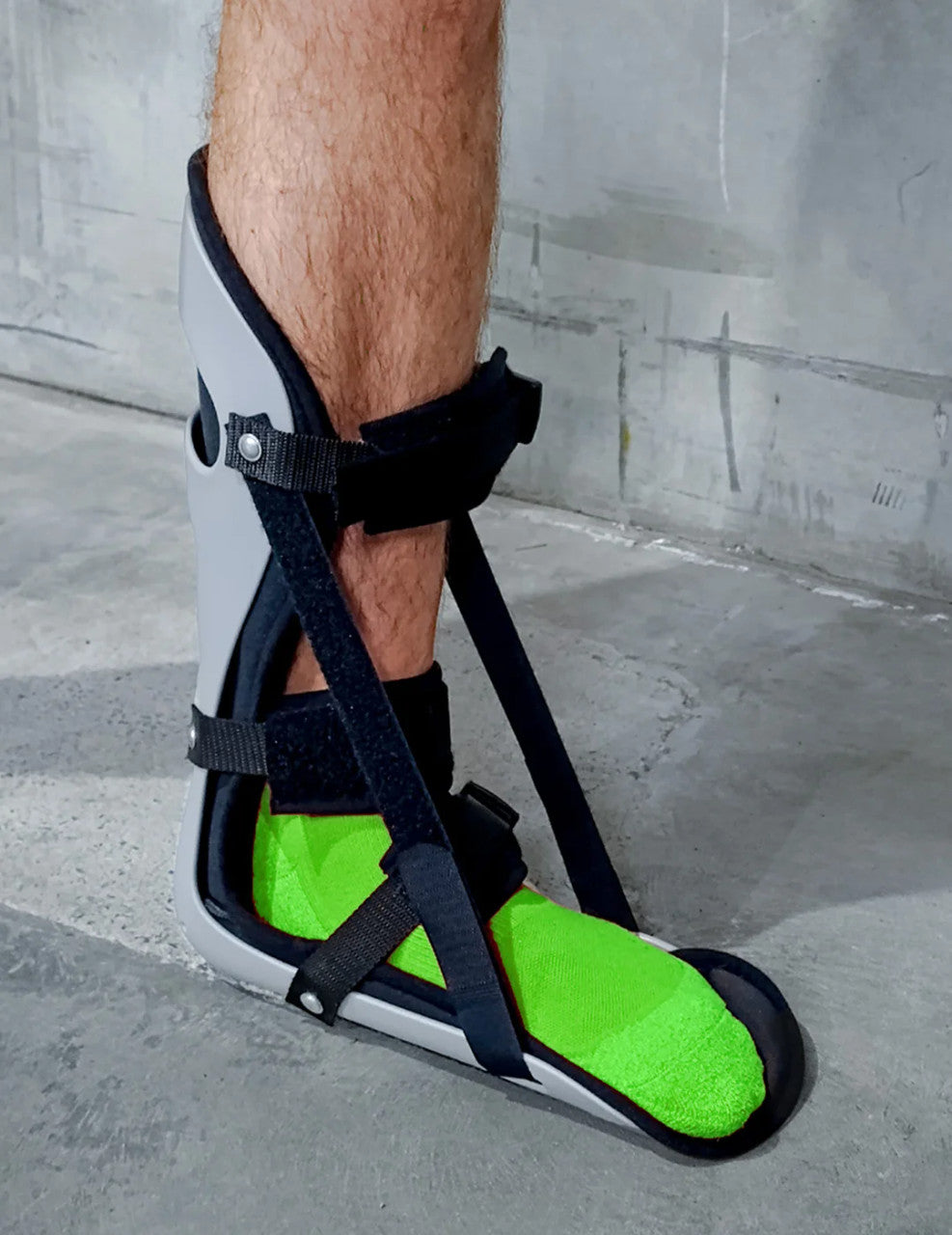 Conwell Night Splint