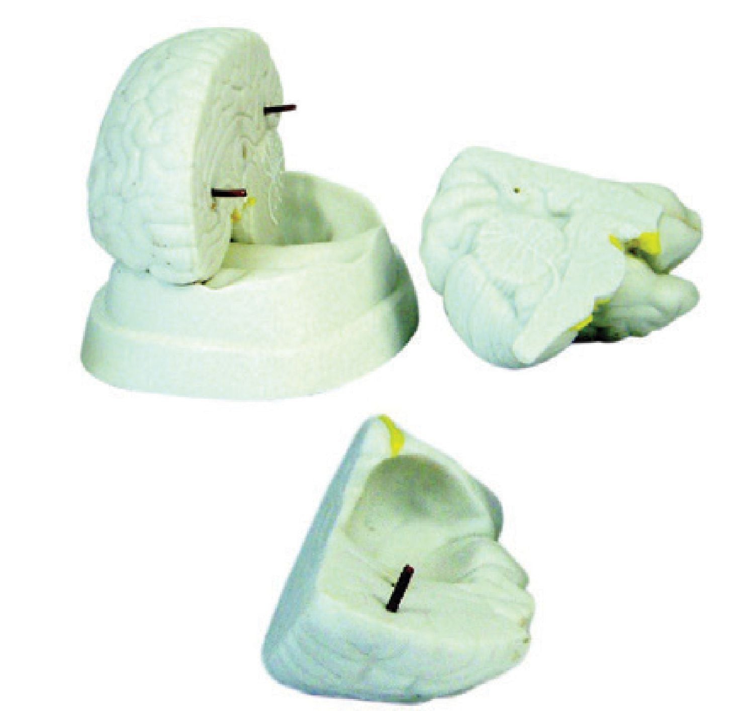 Bodyline Organ Models - Brain