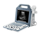 Emperor N2 Real Time Ultrasound / Including Free Convex Probe & Carry Bag