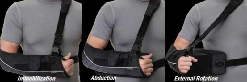 Ossur Smart Sling fitting configuration