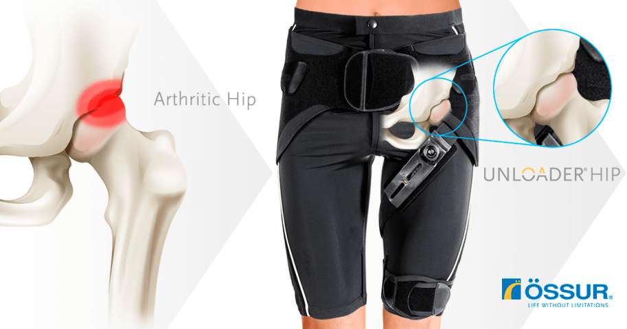 Ossur Unloader Hip brace support features
